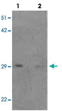 TCTEX1D4, Rabbit, Polyclonal Antibody, Abnova 100 &mu;g | Buy Online | Abnova Corporation | Fisher Scientific