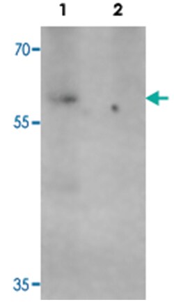 APBA1, Rabbit, Polyclonal Antibody, Abnova 100&mu;g; Unlabeled:Antibodies,