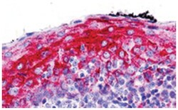 ZMYM4, Rabbit, Polyclonal Antibody, Abnova 100 &mu;g | Buy Online | Abnova Corporation | Fisher Scientific