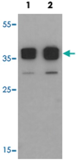 TSPY1 Rabbit anti-Human, Mouse, Polyclonal Antibody, Abnova 100 &mu;g | Buy Online | Abnova Corporation | Fisher Scientific
