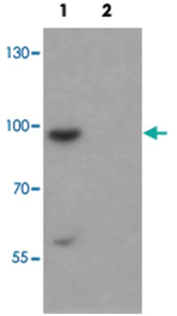 SHROOM1, Rabbit, Polyclonal Antibody, Abnova 100 &mu;g | Buy Online | Abnova Corporation | Fisher Scientific