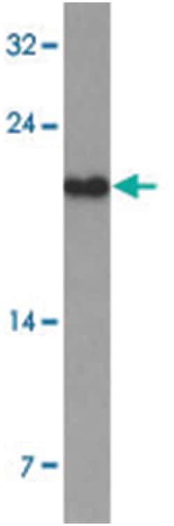 TDGF1 Rabbit anti-Human, Mouse, Rat, Polyclonal Antibody, Abnova 100 &mu;g | Buy Online | Abnova Corporation | Fisher Scientific