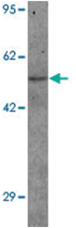 PANX1, Rabbit, Polyclonal Antibody, Abnova 100&mu;g; Unlabeled:Antibodies,