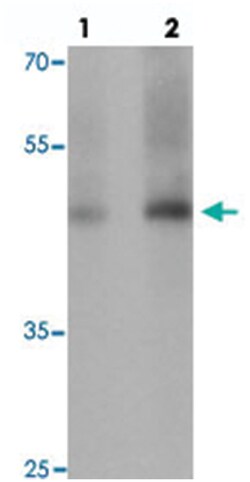 GDF1 Rabbit anti-Human, Mouse, Rat, Polyclonal Antibody, Abnova 100 &mu;g | Buy Online | Abnova Corporation | Fisher Scientific