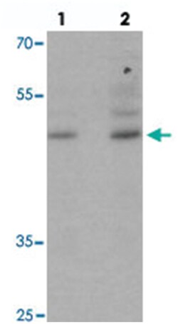 POU3F2, Rabbit, Polyclonal Antibody, Abnova 100 &mu;g | Buy Online | Abnova Corporation | Fisher Scientific