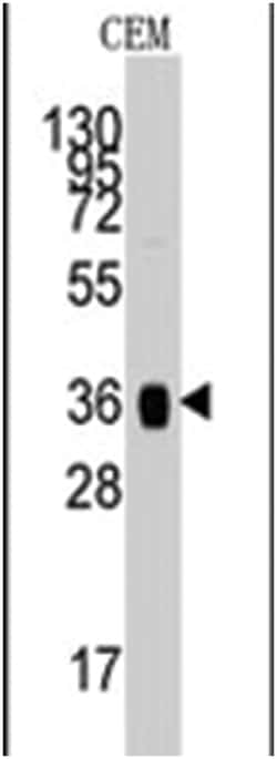 ALDOA Rabbit anti-Human, Polyclonal Antibody, Abnova 400&mu;L; Unlabeled:Antibodies,