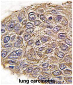 ALDOA Rabbit anti-Human, Polyclonal Antibody, Abnova 400&mu;L; Unlabeled:Antibodies,