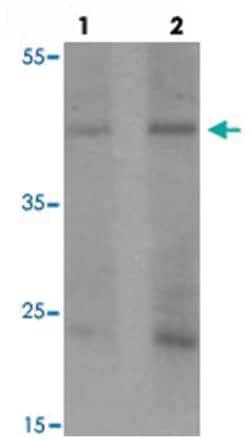 PELI1, Rabbit, Polyclonal Antibody, Abnova 100 &mu;g | Buy Online | Abnova Corporation | Fisher Scientific