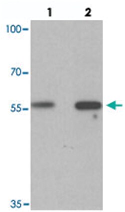 GHDC, Rabbit, Polyclonal Antibody, Abnova 100μg; Unlabeled:Antibodies,