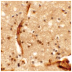 KCNK13, Rabbit, Polyclonal Antibody, Abnova 100&mu;g; Unlabeled:Antibodies,