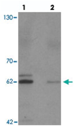 KCNK13, Rabbit, Polyclonal Antibody, Abnova 100&mu;g; Unlabeled:Antibodies,