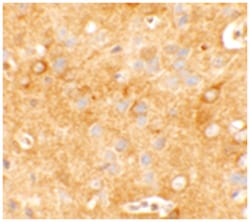 KCNK12, Rabbit, Polyclonal Antibody, Abnova 100 &mu;g | Buy Online | Abnova | Fisher Scientific