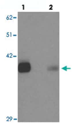 KCNK12, Rabbit, Polyclonal Antibody, Abnova 100 &mu;g | Buy Online | Abnova | Fisher Scientific