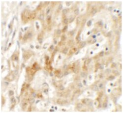 TMEM106B, Rabbit, Polyclonal Antibody, Abnova 100&mu;g; Unlabeled:Antibodies,