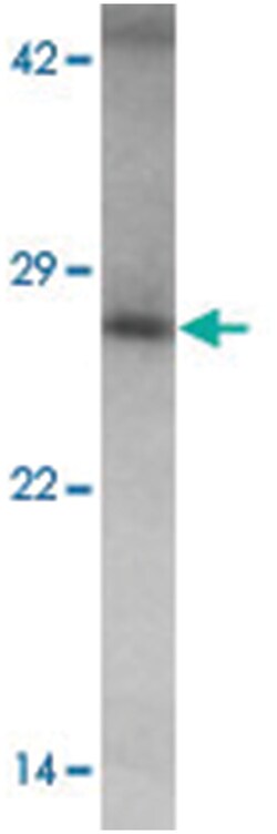 TMEM106B, Rabbit, Polyclonal Antibody, Abnova 100&mu;g; Unlabeled:Antibodies,