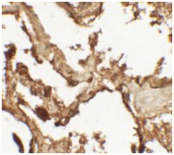 VKORC1 Rabbit anti-Human, Mouse, Polyclonal Antibody, Abnova 100 &mu;g | Buy Online | Abnova Corporation | Fisher Scientific