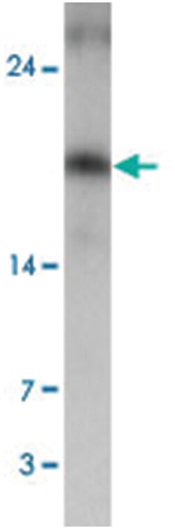 VKORC1 Rabbit anti-Human, Mouse, Polyclonal Antibody, Abnova 100 &mu;g | Buy Online | Abnova Corporation | Fisher Scientific