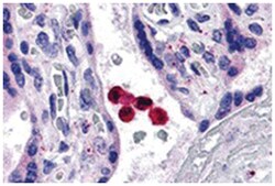 TLR4 Rabbit anti-Human, Polyclonal Antibody, Abnova 100&mu;g; Unlabeled:Antibodies,