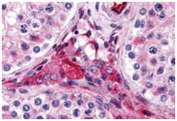 PTCHD2 Rabbit anti-Human, Polyclonal Antibody, Abnova 100 &mu;g | Buy Online | Abnova Corporation | Fisher Scientific