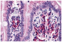 ANKRD27 Rabbit anti-Human, Polyclonal Antibody, Abnova 100&mu;g; Unlabeled:Antibodies,