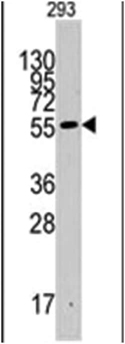 IDO1 Rabbit anti-Human, Polyclonal Antibody, Abnova 400 &mu;L | Buy Online | Abnova Corporation | Fisher Scientific