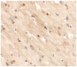 TMEM59L Rabbit anti-Human, Mouse, Rat, Polyclonal Antibody, Abnova 100&mu;g;