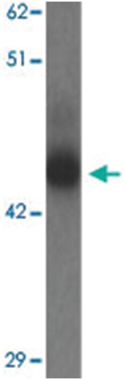 TMEM59L Rabbit anti-Human, Mouse, Rat, Polyclonal Antibody, Abnova 100&mu;g;