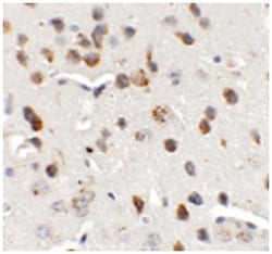 CHD7 Rabbit anti-Human, Mouse, Polyclonal Antibody, Abnova 100&mu;g; Unlabeled:Antibodies,