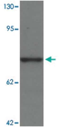 PALM3, Rabbit, Polyclonal Antibody, Abnova 100&mu;g; Unlabeled:Anticuerpos