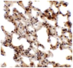 CORO7, Rabbit, Polyclonal Antibody, Abnova 100&mu;g; Unlabeled:Antibodies,