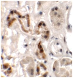 DBX1, Rabbit, Polyclonal Antibody, Abnova 100&mu;g; Unlabeled:Antibodies,