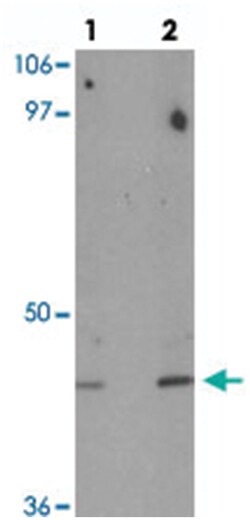 DBX1, Rabbit, Polyclonal Antibody, Abnova 100&mu;g; Unlabeled:Antibodies,
