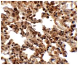 FXYD7 Rabbit anti-Human, Mouse, Rat, Polyclonal Antibody, Abnova 100&mu;g;