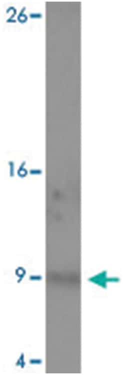 FXYD7 Rabbit anti-Human, Mouse, Rat, Polyclonal Antibody, Abnova 100&mu;g;