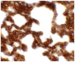 NETO1, Rabbit, Polyclonal Antibody, Abnova 100&mu;g; Unlabeled:Antibodies,