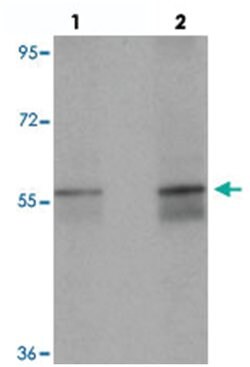 NETO1, Rabbit, Polyclonal Antibody, Abnova 100&mu;g; Unlabeled:Antibodies,
