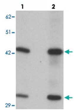 SEC62 Rabbit anti-Human, Mouse, Rat, Polyclonal Antibody, Abnova 100&mu;g;