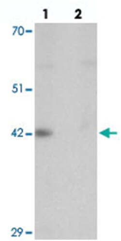 DPAGT1, Rabbit, Polyclonal Antibody, Abnova 100&mu;g; Unlabeled:Antibodies,