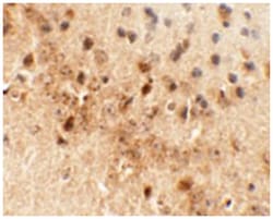 DRAXIN Rabbit anti-Human, Mouse, Rat, Polyclonal Antibody, Abnova 100&mu;g;