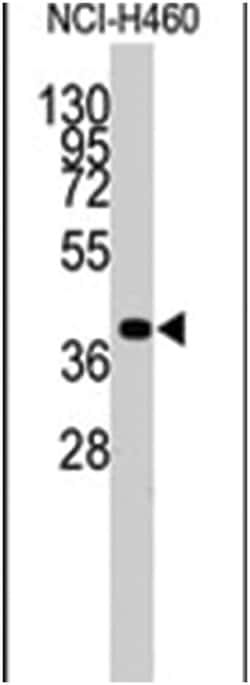 LECT1, Rabbit, Polyclonal Antibody, Abnova 400 &mu;L | Buy Online | Abnova Corporation | Fisher Scientific