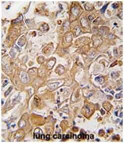 LECT1, Rabbit, Polyclonal Antibody, Abnova 400 &mu;L | Buy Online | Abnova Corporation | Fisher Scientific