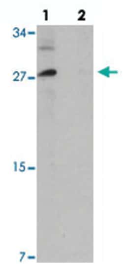 UPK1B, Rabbit, Polyclonal Antibody, Abnova 100&mu;g; Unlabeled:Antibodies,