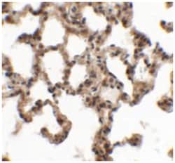 SPINK7, Chicken, Polyclonal Antibody, Abnova 100&mu;g; Unlabeled:Antibodies,