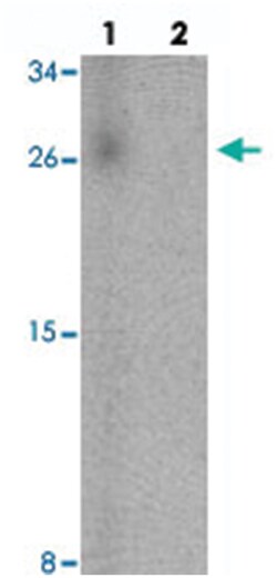 SPINK7, Chicken, Polyclonal Antibody, Abnova 100&mu;g; Unlabeled:Antibodies,