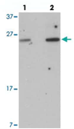 C2orf40 Rabbit anti-Human, Mouse, Rat, Polyclonal Antibody, Abnova 100&mu;g;