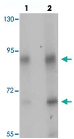 TGM5, Rabbit, Polyclonal Antibody, Abnova 100&mu;g; Unlabeled:Antibodies,