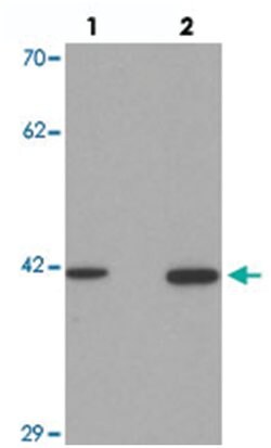 SLC35D2, Rabbit, Polyclonal Antibody, Abnova 100&mu;g; Unlabeled:Antibodies,