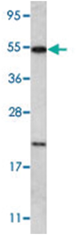 NANOS2 Rabbit anti-Human, Polyclonal Antibody, Abnova 400 &mu;L | Buy Online | Abnova Corporation | Fisher Scientific