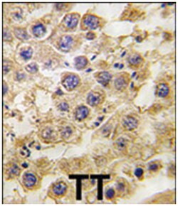 NANOS2 Rabbit anti-Human, Polyclonal Antibody, Abnova 400 &mu;L | Buy Online | Abnova Corporation | Fisher Scientific