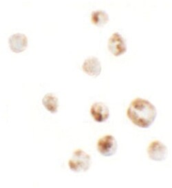 AFAP1L1, Rabbit, Polyclonal Antibody, Abnova 100 &mu;g | Buy Online | Abnova | Fisher Scientific